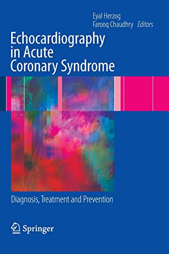 9781848820265: Echocardiography in Acute Coronary Syndrome: Diagnosis, Treatment and Prevention