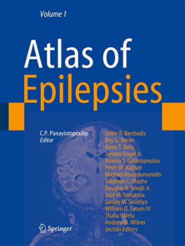 Imagen de archivo de Atlas of Epilepsies a la venta por Books of the Smoky Mountains