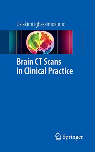 9781848823648: Brain CT Scans in Clinical Practice