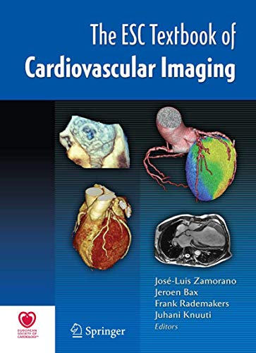 9781848824201: The ESC Textbook of Cardiovascular Imaging