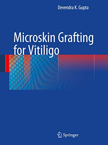 Stock image for Microskin Grafting for Vitiligo. for sale by Gast & Hoyer GmbH