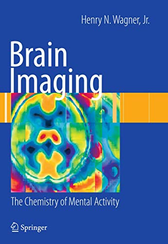 Beispielbild fr Brain Imaging: The Chemistry of Mental Activity zum Verkauf von CSG Onlinebuch GMBH