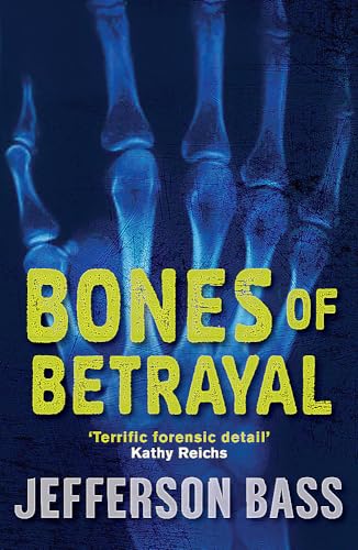 9781849160551: Bones of Betrayal (The Body Farm)