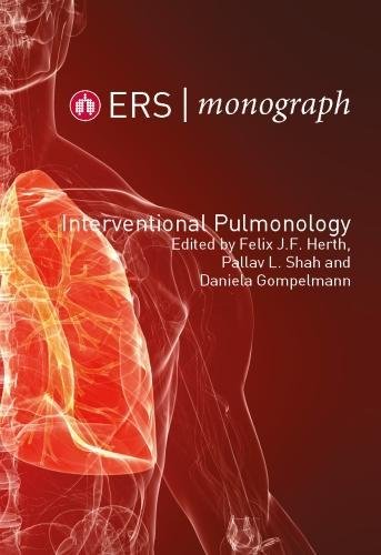 Stock image for Interventional Pulmonology for sale by Eastleach Books