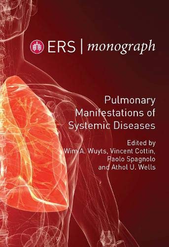 Stock image for Pulmonary Manifestations Of Systemic Diseases for sale by Eastleach Books