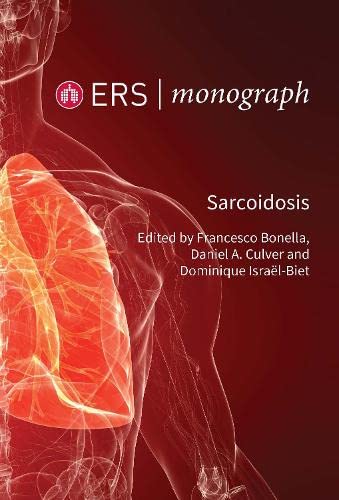 Stock image for Sarcoidosis for sale by Eastleach Books