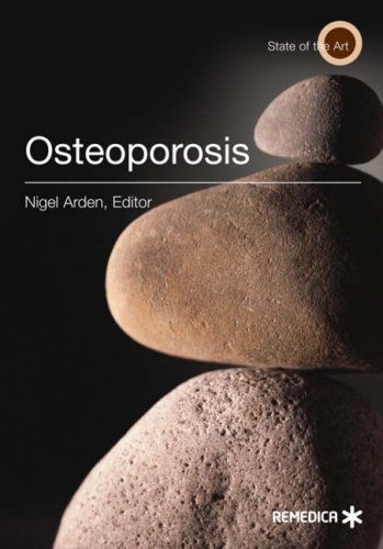 Imagen de archivo de Osteoporosis a la venta por Better World Books