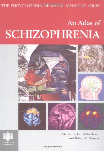 Atlas of Schizophrenia (Encyclopedia of Visual Medicine Series) (9781850700746) by Stefan, Martin; Travis, Mike; Murray, Robin