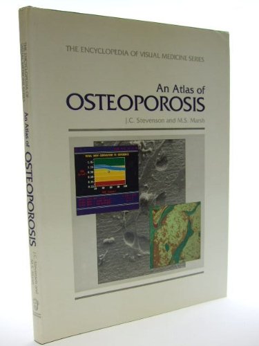 Stock image for An Atlas of Osteoporosis (The Encyclopedia of Visual Medicine Series) for sale by medimops