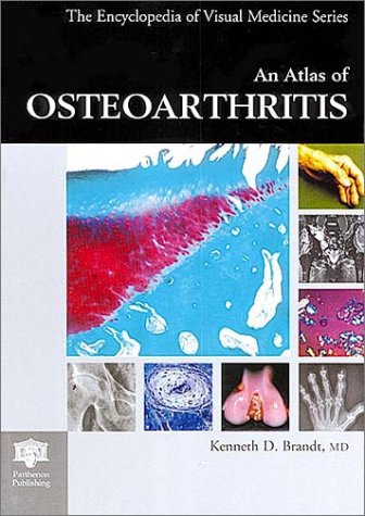 Imagen de archivo de An Atlas of Osteoarthritis a la venta por Wonder Book