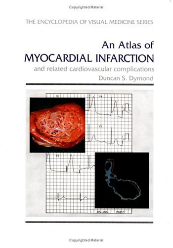 An Atlas Of Myocardial Infarction: And Related Cardiovascular Complications