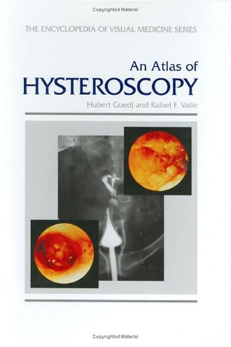 Beispielbild fr An Atlas of Hysteroscopy (Encyclopedia of Visual Medicine Series) zum Verkauf von HPB-Red