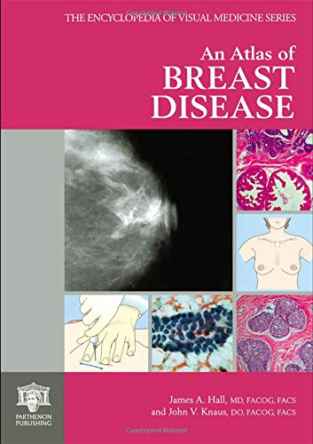 Beispielbild fr An Atlas of Breast Disease zum Verkauf von Better World Books