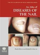 Beispielbild fr An Atlas of Diseases of the Nail zum Verkauf von Blackwell's