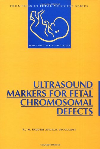 Beispielbild fr Ultrasound Markers for Fetal Chromosomal Defects (Frontiers in Fetal Medicine) zum Verkauf von HPB-Red