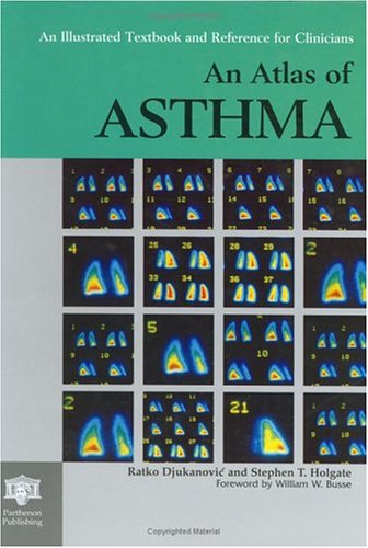 Stock image for An Atlas of Asthma (Encyclopedia of Visual Medicine Series) for sale by Blue Vase Books