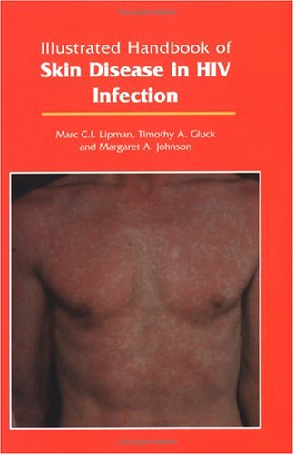 Illustrated Handbook of Skin Disease in HIV Infection (9781850709763) by Lipman, M.C.I.; Gluck, Timothy A.; Johnson, Margaret A.
