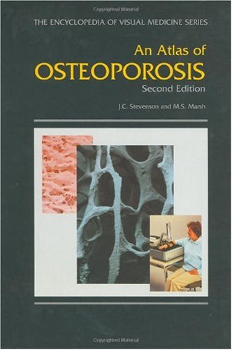 9781850709879: An Atlas of Osteoporosis