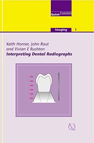 Stock image for Interpreting Dental Radiographs (Imaging Vol. 1) (Quintessentials of Dental Practice) for sale by GF Books, Inc.