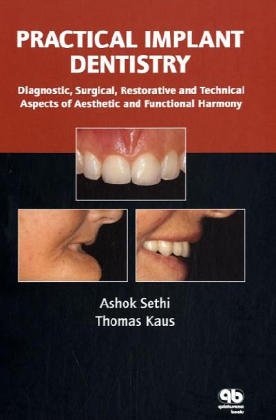 9781850970613: Practical Implant Dentistry: Diagnostic, Surgical, Restorative And Technical Aspects Of Aesthetic And Functional Harmony