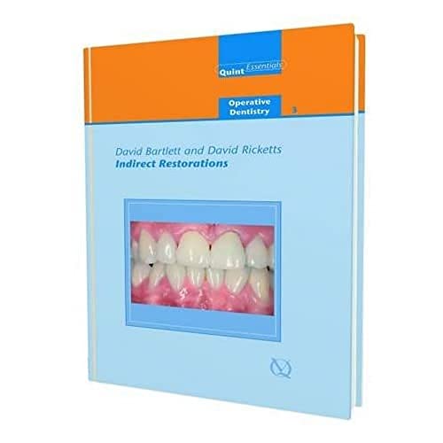 Beispielbild fr Indirect Restorations (Quintessentials of Dental Practice) zum Verkauf von The Maryland Book Bank