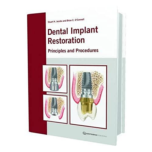 Stock image for The Restoration of Dental Implants with Fixed Prosthesis: Principles and Procedures for sale by WorldofBooks