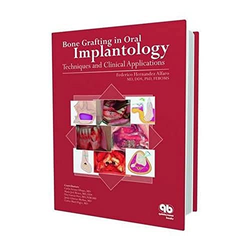 9781850971030: Bone Grafting in Oral Implantology : Techniques and Clinical Applications