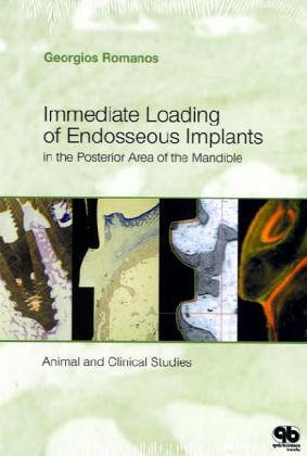 Stock image for Immediate Loading of Endosseous Implants in the Posterior Mandible for sale by Books Puddle