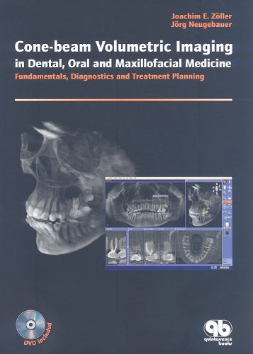 Beispielbild fr Cone-beam Volumetric Imaging in Dental, Oral and Maxillofacial Medicine: Fundamentals, Diagnostics and Treatment Planning zum Verkauf von HPB-Red