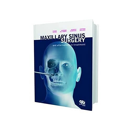 Imagen de archivo de Maxillary Sinus Surgery and Alternatives in Treatment a la venta por Books Puddle