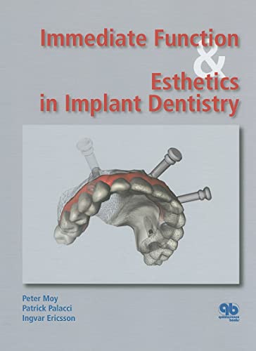 Beispielbild fr Immediate Function and Esthetics in Implant Dentistry zum Verkauf von Mispah books