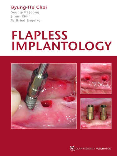 9781850971955: Flapless Implantology