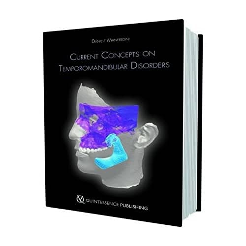 9781850971993: Current Concepts on Temporomandibular Disorders