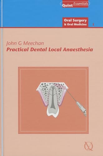9781850972044: Practical Dental Local Anaesthesia
