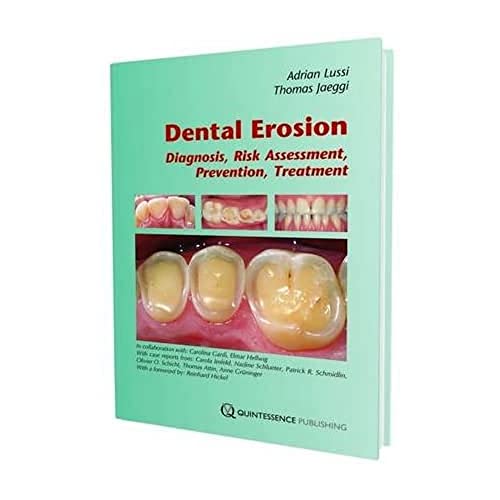 Stock image for Dental Erosion for sale by WeBuyBooks
