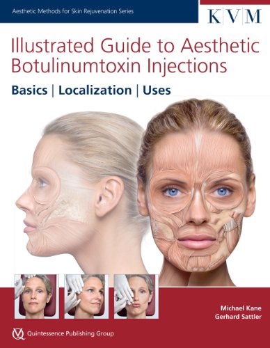 9781850972501: Illustrated Guide to Aesthetic Botulinum Toxin Injections (Aesthetic Methods for Skin Rejuvenation)