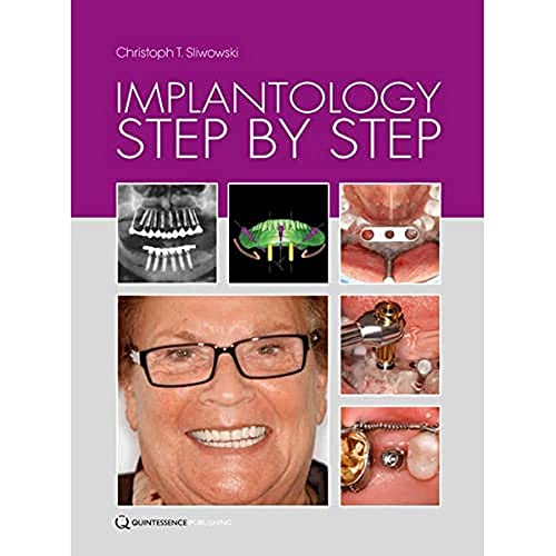 Stock image for Implantology Step by Step for sale by Seattle Goodwill