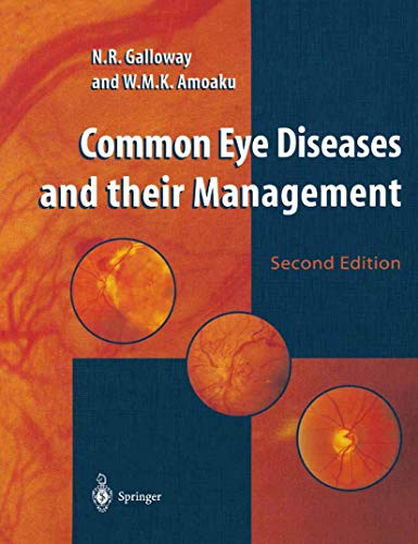 Imagen de archivo de Common Eye Diseases and Their Management a la venta por Better World Books