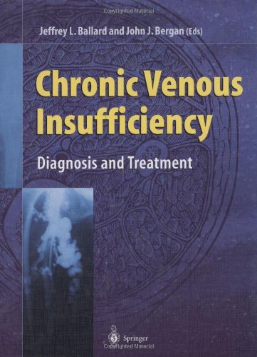 9781852331726: Venous Insufficiency: Diagnosis and Treatment