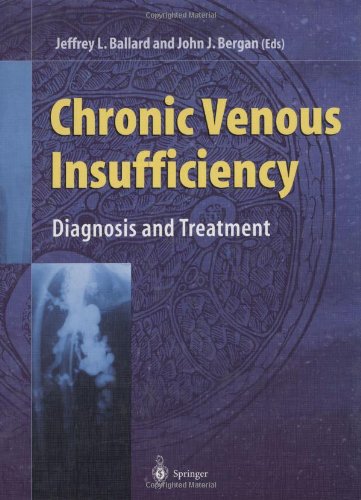 Chronic Venous Insufficiency - Diagnosis and Treatment