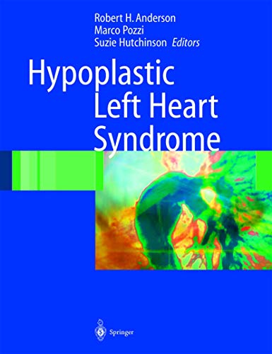 9781852337650: Hypoplastic Left Heart Syndrome