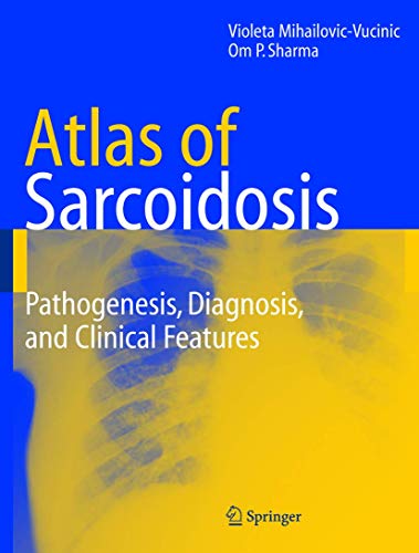 9781852338091: An Atlas of Sarcoidosis