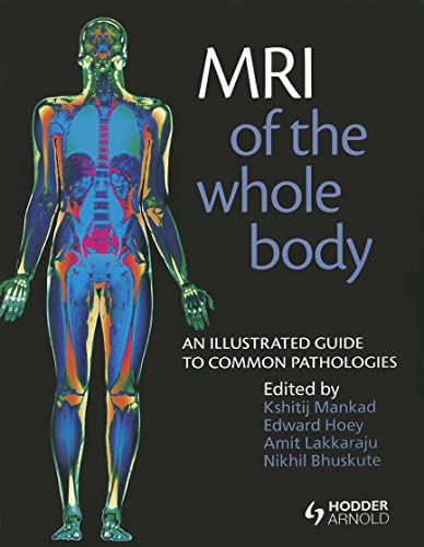 Stock image for MRI of the Whole Body: An Illustrated Guide for Common Pathologies for sale by Goodwill Southern California