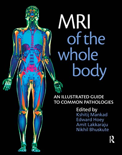 9781853157769: MRI of the Whole Body: An Illustrated Guide for Common Pathologies