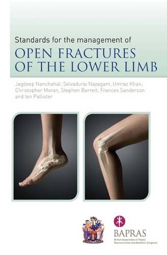 Stock image for The Standards for the Management of Open Fractures of the Lower Limb for sale by WorldofBooks