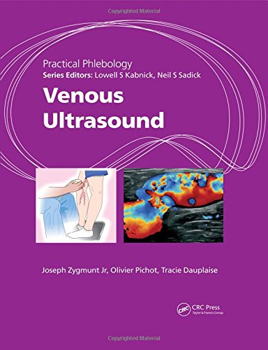 Stock image for Practical Phlebology: Venous Ultrasound for sale by GoldenWavesOfBooks