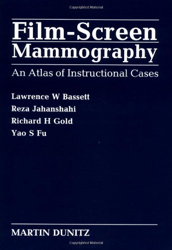 Stock image for Film-Screen Mammography for sale by Books Puddle