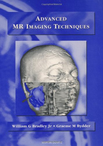 Advanced MR Imaging Techniques (9781853170249) by Bradley, William G.; Bydder, Graeme