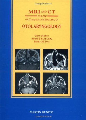 9781853170379: MRI and CT Atlas of Correlative Imaging in Otolaryngology
