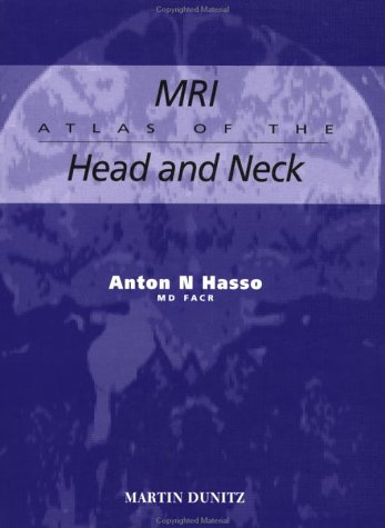9781853170676: MRI Atlas of the Head and Neck